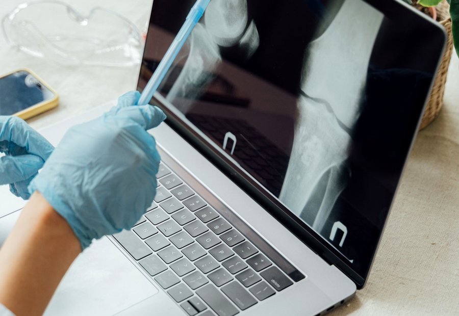 Bone tumor diagnostic care