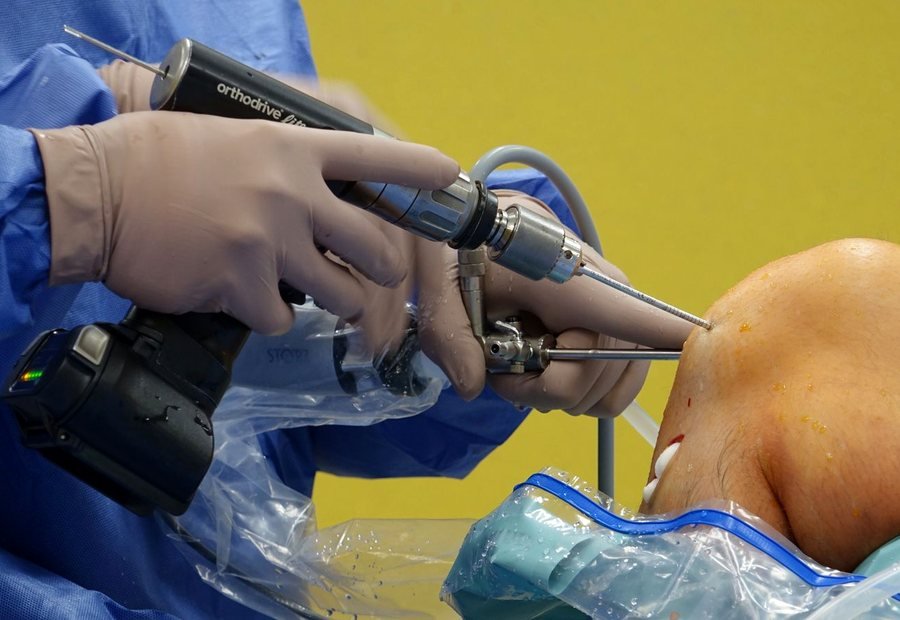 Knee arthroscopy service