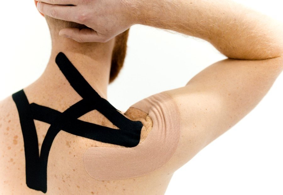 Rotator Cuff Tear