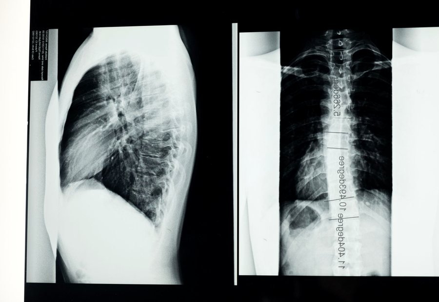 Spine surgery service